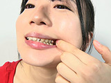 銀歯フェチ！口内歯観察 安達まどか