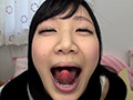 歯フェチ！相互口内観察レズ銀歯あり！