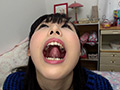 歯フェチ！相互口内観察レズ銀歯あり！