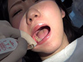 歯科治療映像 柏木茉奈 前編・中篇・後編 フルセット！
