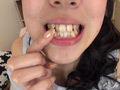牧野れいなちゃんの歯・口内自撮り＆ベロ観察