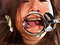 ○制嘔吐3