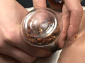 蜚蠊に難い雌襞と○蝕に斑液