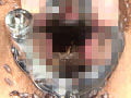蜚蠊に嗤い蚕桑と膣緩に潰瘍