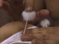 肛門5