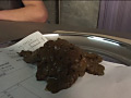 大便白書10
