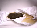 大便白書14
