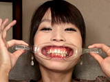 口腔羞恥！！ 素人歯科淫診 素人OLの小春ちゃん編