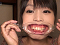 口腔羞恥！！ 素人歯科淫診 素人OLの小春ちゃん編