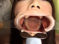 口腔羞恥！！ 素人歯科淫診02 派遣社員の優美ちゃん編