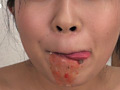 口腔咀嚼診察 粘膜剥き出し！！開口器美女 高沢沙耶