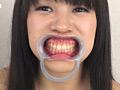 口腔粘膜剥き出し絶頂！！開口狂器 倉科もえ