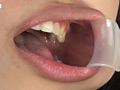 口腔粘膜剥き出し絶頂！！開口狂器 倉科もえ