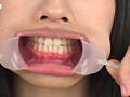 口腔粘膜剥き出し絶頂！！開口狂器 倉科もえ
