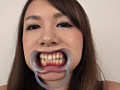 フェチ選！！ 口腔歯科淫診