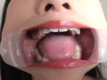 フェチ選！！羞恥歯科医淫！おっぴろげ口腔紀行