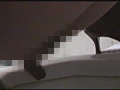 大便排泄視感2
