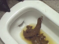 大便排泄視感2