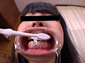 お姉さん達の口の中 口腔観察で感じる女達