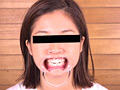お姉さん達の口の中 口腔観察で感じる女達