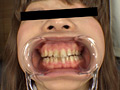 お姉さん達の口の中 口腔観察で感じる女達