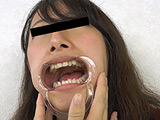 歯、痛いですか？ 素人娘たちの意識調査