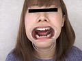 歯、痛いですか？ 素人娘たちの意識調査
