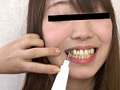 歯、痛いですか？ 素人娘たちの意識調査