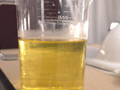 リッター膀胱コレクション4