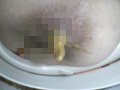 ○撮、便秘浣腸女子○生！！