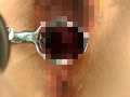純白ナースの膣内観察