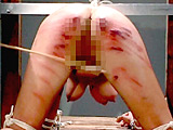 血針鞭