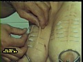 刺醜 ～ししゅう～4