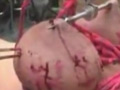 破壊遊戯4 ～傷と鮮血に彩られた肉体～
