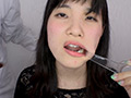 新口腔内観察 - まなみ by 口腔仙人（Dr. X）