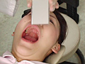 歯科衛生女子 淫 口内観察