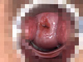 子宮口むき出しオナニー