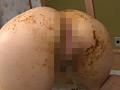 膣とアナル往復 腸液糞まみれマンコ中出しセックス