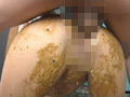スカトロ脱糞ガン突きSEX