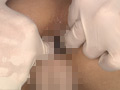 人妻熟女アナル拡張 なんでも飲み込むケツマ○コに変貌