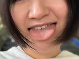 街角口内01