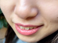 街角で声をかけて口内観察させてもらう ゆゆちゃん