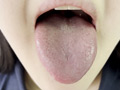 街角で声をかけて口内観察させてもらう りかちゃん
