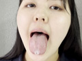 街角で声をかけて口内観察させてもらう りかちゃん