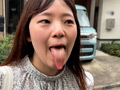 街角で声をかけて口内観察させてもらう あいるちゃん