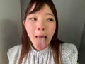 街角で声をかけて口内観察させてもらう あいるちゃん