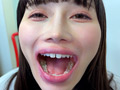 街角で声をかけて口内観察させてもらう ひなみちゃん