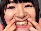 街角で声をかけて口内観察させてもらう みこちゃん