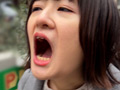 街角で声をかけて口内観察させてもらう みこちゃん