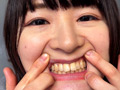街角で声をかけて口内観察させてもらう みこちゃん